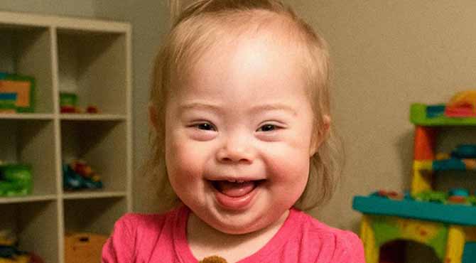 I Adopted a Girl with Down Syndrome That No One Wanted Right After I Saw 11 Rolls-Royces Parking in Front of My Porch