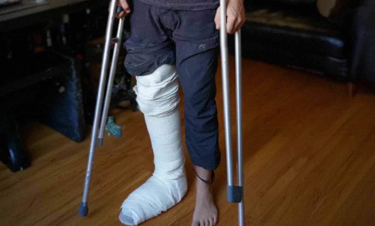 My Husband Showed Up with a Cast on His Leg the Day Before Our First Family Vacation – Then I Got a Call That Changed Everything