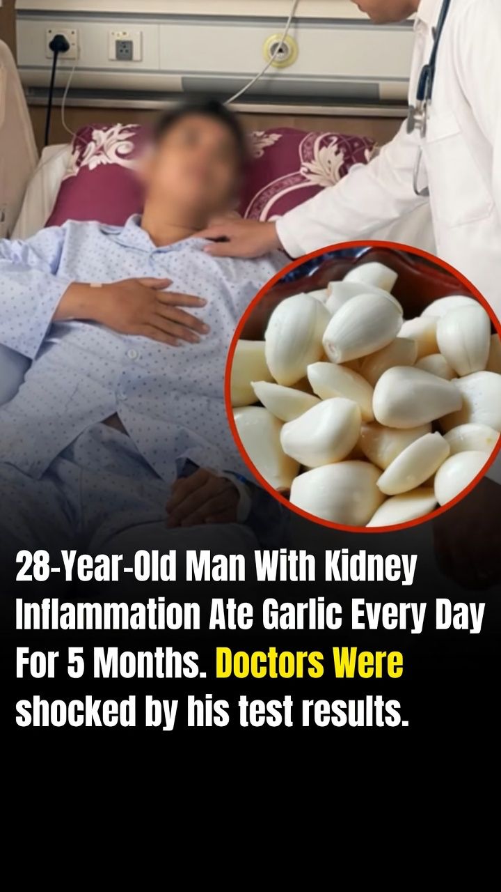 Garlic and Kidney Inflammation: Can This Trusted Kitchen Staple Support Your Health?