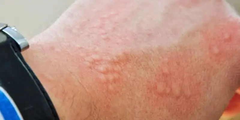 The Deadly Warning Signs Your Skin Is Sending You That You Should Never Ignore