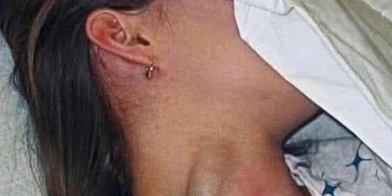 SENSATIONAL TRAGEDY Young Woman Loss Sparks Massive Global Conversation On Hidden Health Dangers