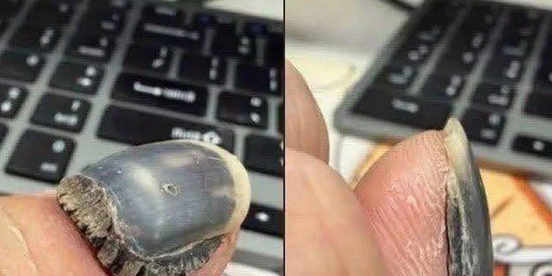 These are the consequences of sleeping with a…
